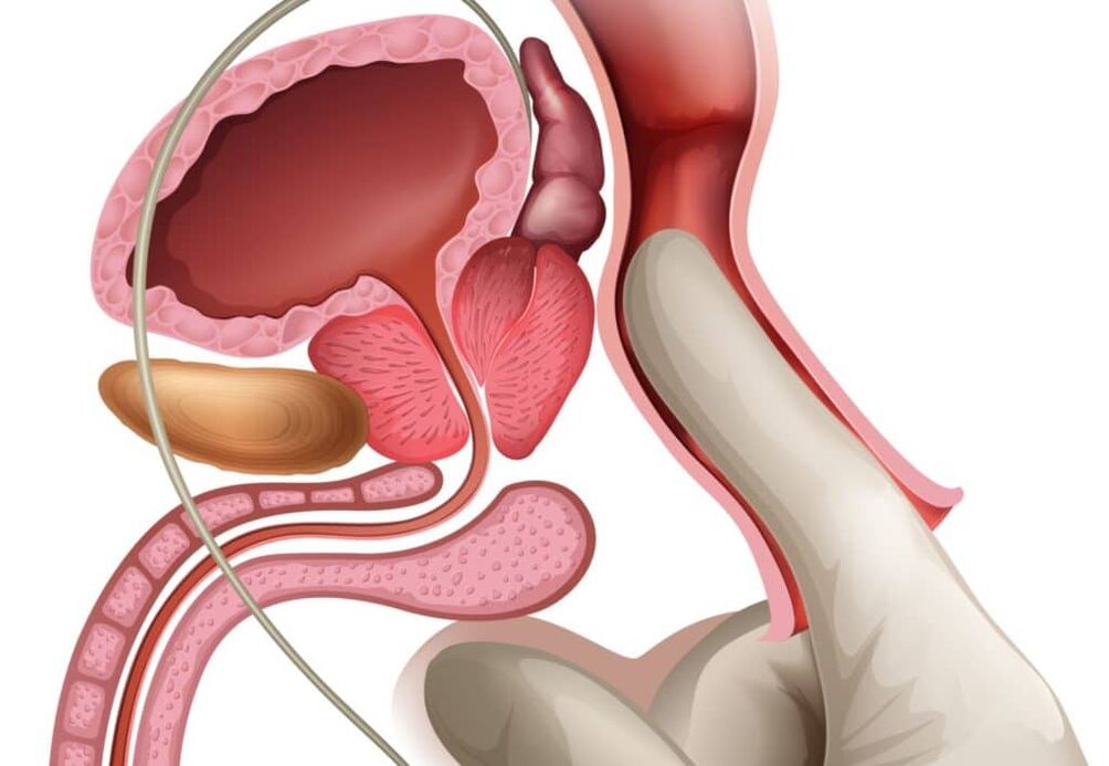 Massaggio alla prostata